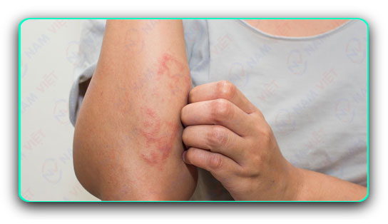 9 lầm tưởng thường gặp về ung thư da